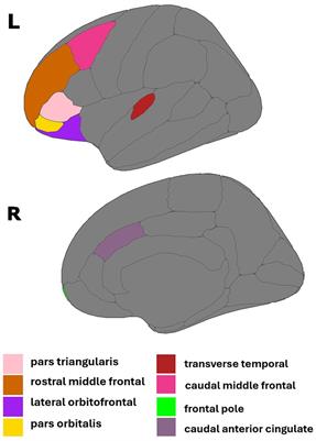 Associations of endogenous estrogens, plasma Alzheimer’s disease biomarkers, and APOE4 carrier status on regional brain volumes in postmenopausal women